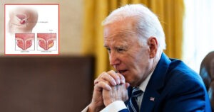 Breaking News! លោក Joe Biden មានជំងឺមហារីកក្រពេញប្រូស្តាតដែលមានអត្រារស់តិចបំផុត